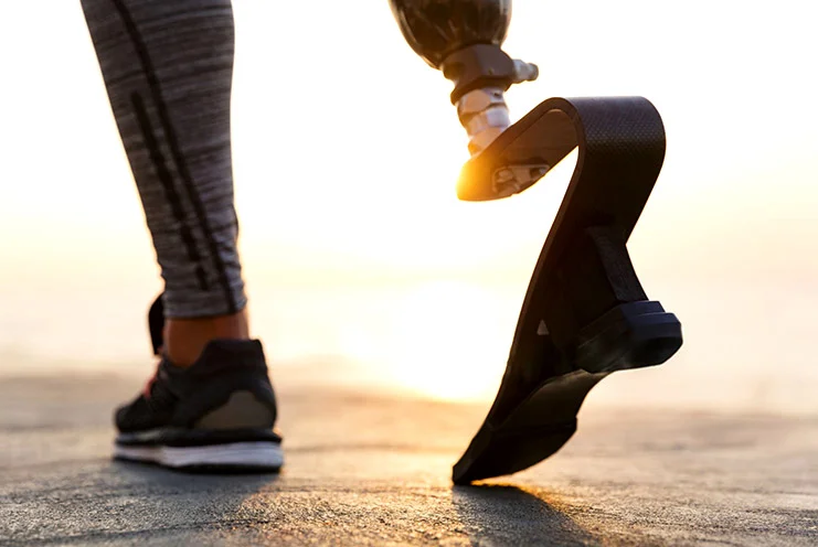 Choosing the right Prosthetic Foot: Types, Features & How to Select Yours