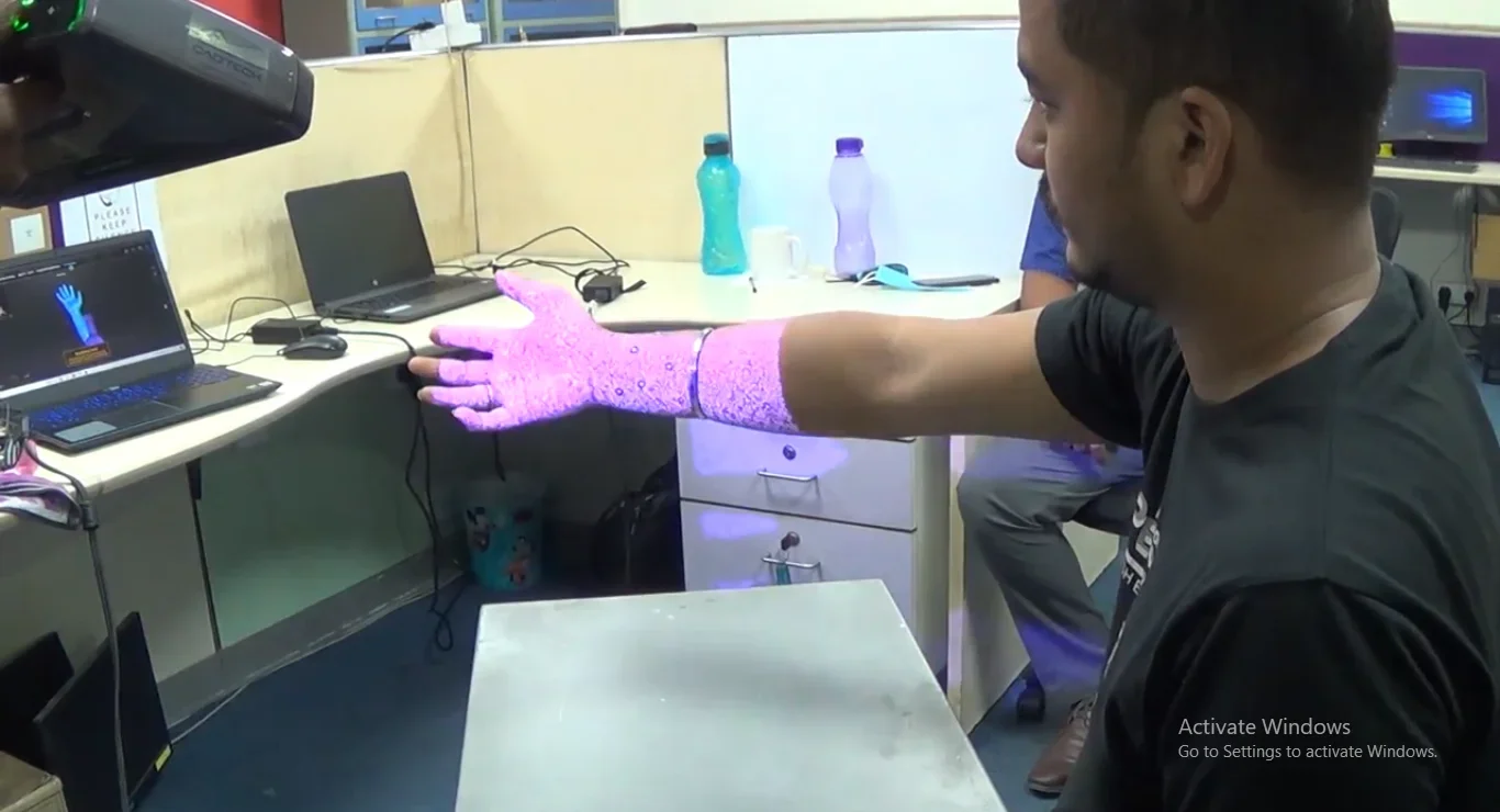 3d scan for prosthetics hand