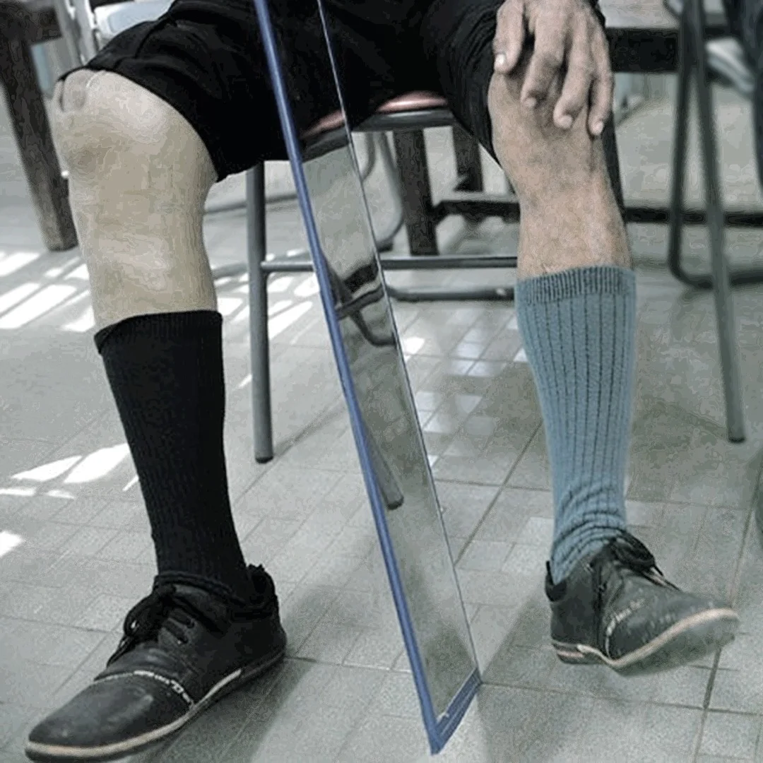 Seven easy therapies to get rid of your Phantom Pain!