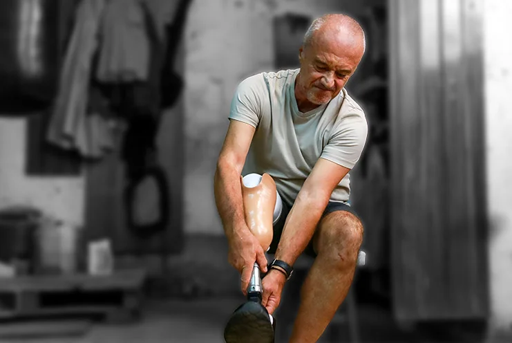 When Walking Feels Human Again: Solving Below-Knee Prosthesis Discomfort with Perfect Socket Designs