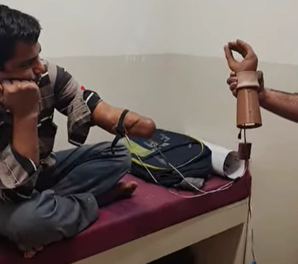 Patient of Vispala Technologies with AtriEX