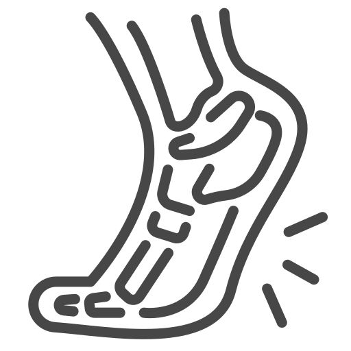 Plantar Fasciitis