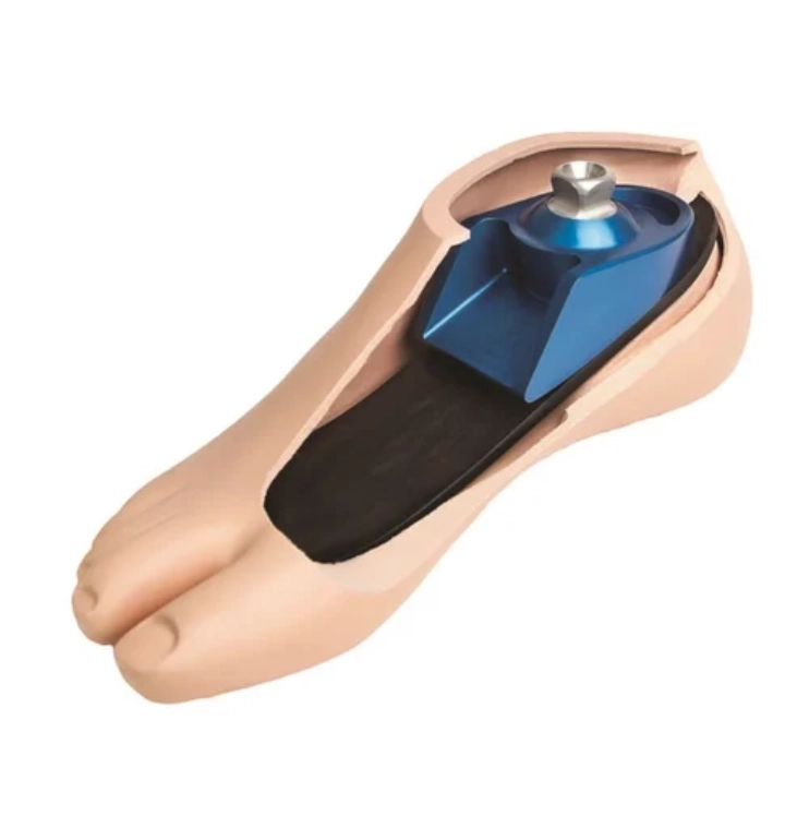 Breeze Prosthetic Foot