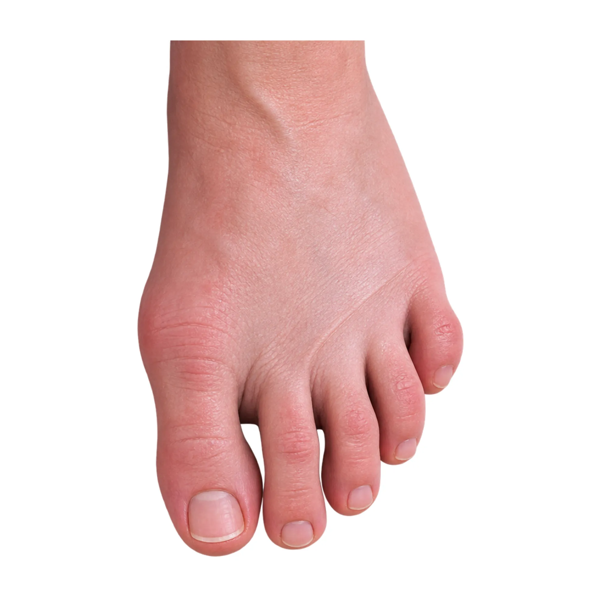 great toe with band