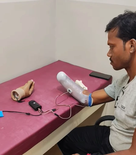 Training and Adjustment of Prosthetics