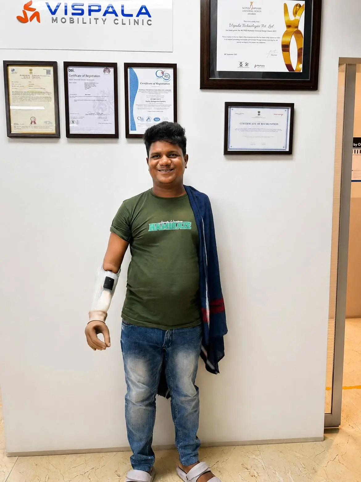 patient with prosthetic hand of Vispala Technologies